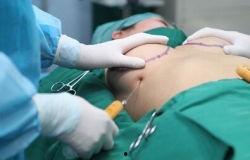 女子隆胸照片 第3张 女子隆胸照片 第3张